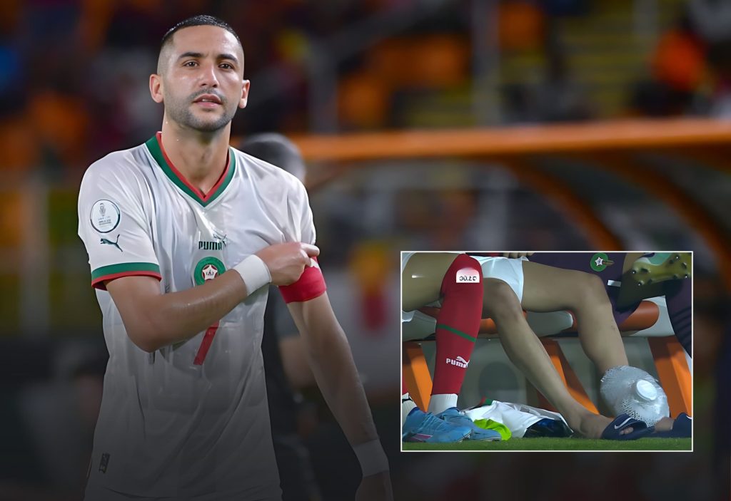 هل يغيب زياش عن مباراة جنوب إفريقيا؟