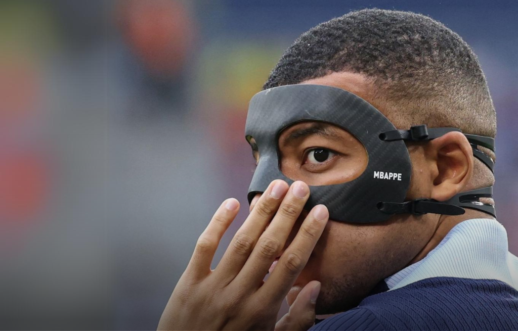 يورو 2024.. مبابي يتحسن تدريجيا من إصابته في الأنف