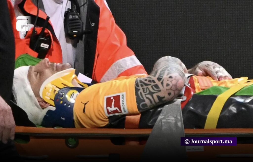 ارتجاج دماغي لحارس هايدنهايم