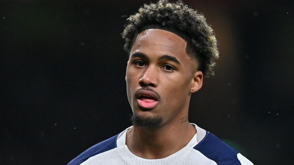 توتنهام يفقد خدمات أودوبير بسبب تمزق الرباط الصليبي